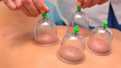 تفسير حلم الحجامة في المنام وعلاقته بالشفاء من الأمراض 