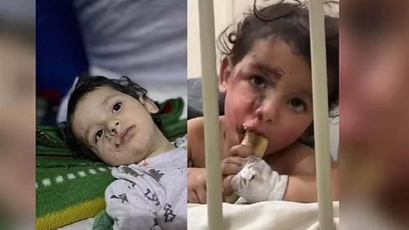 الطفل السوري إبراهيم،