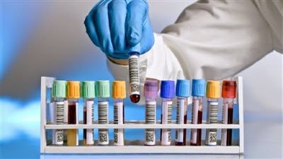 مافيا التحاليل الطبية.. كواليس سيطرة 3 معامل كبرى على سوق التحاليل في مصر.. السلاسل تفرض أسعار التحاليل في غياب الأجهزة الرقابية.. مطالب بتعميم تطبيق الجودة على المعامل الخاصة