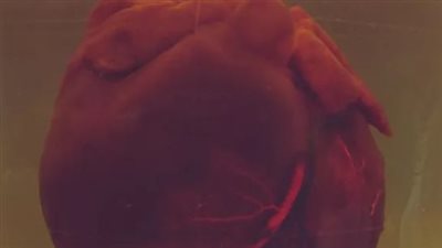 الكشف عن قلب روبوتي يتمدد ويتقلص كالحقيقي (فيديو)