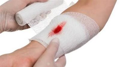 هل يساعد استخدام البن في التئام الجروح؟ الصحة توضح