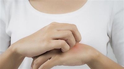 أعراض حساسية الفاكهة وأسباب الإصابة بها