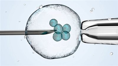 الحقن المجهري وأهم الخطوات في مستشفى بداية