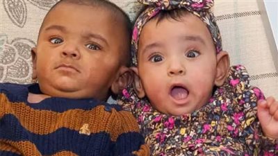 توأم بحجم كف اليد يدخل جينيس