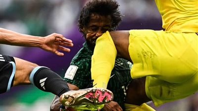 دراسة علمية حديثة تكشف أكثر الأمراض التي تهدد لاعبي كرة القدم