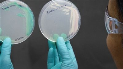 دراسة تكشف عن فطريات قاتلة تنتشر في أمريكا