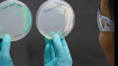 10 معلومات عن فطر كانديدا أوريس القاتل بعد ظهوره في أمريكا (فيديوجراف)