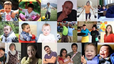 تعرف على أسباب الإصابة وأعراض متلازمة داون في اليوم العالمي لها