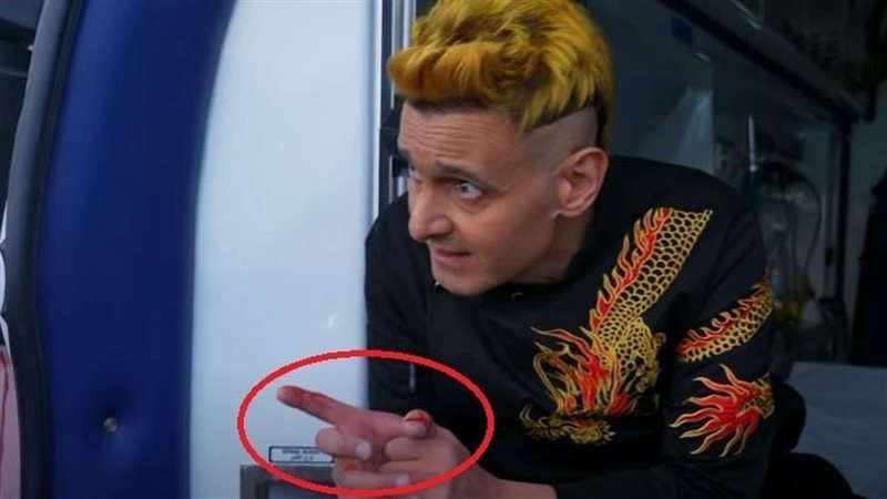 رامز جلال يتعرض للدغة