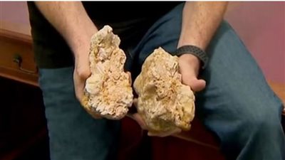 أسترالي محظوظ يعثر على صخرة بمئات آلاف الدولارات (صور)