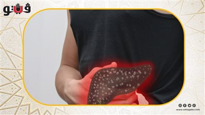 معهد التغذية يكشف تأثير السمنة على مرضى الكبد 