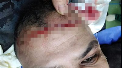 إصابة شاب مزقه جاره بسكين بسبب دفاعه عن أطفاله بالغربية 
