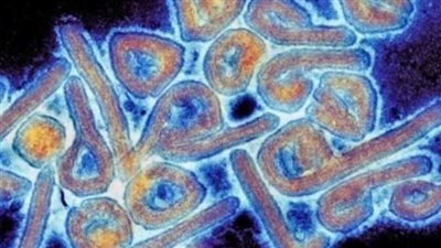 أستاذ علم أوبئة: نسبة الوفيات من فيروس ماربورج تصل إلى 88%