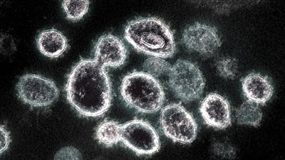 موجود فى كل بيت.. حل سحرى يقلل من تفشى كورونا