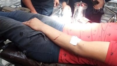 طوارئ طنطا الجامعي تنقذ يد شاب من البتر