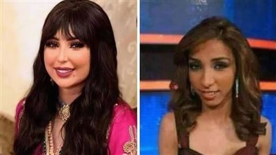 شكلها تغير ١٨٠ درجة.. دنيا بطمة قبل وبعد عمليات التجميل 