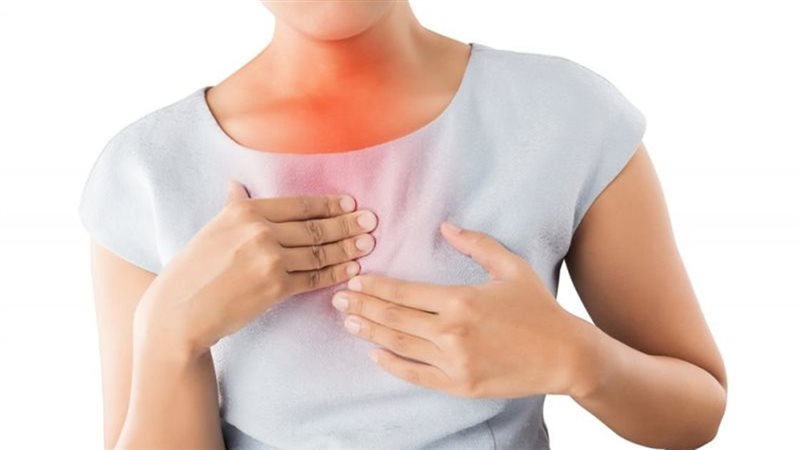 علاج حرقة المعدة
