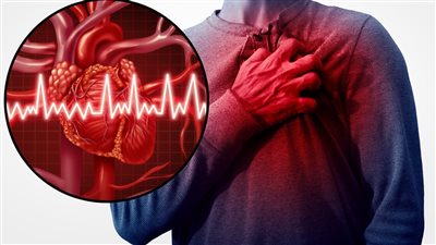 أسباب وأعراض مرض ارتخاء الصمام (فيديو)