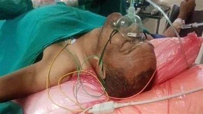 إصابة بالغة لقائد ميليشيا الدعم السريع بمطار مروي