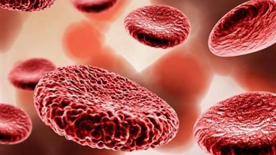 يصيب 10 آلاف مريض في مصر، كل ما تريد معرفته عن مرض الهيموفيليا