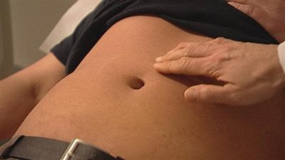 أسباب الفتق السري عند البالغين وطرق علاجه