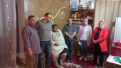 محافظ بني سويف يوجه بفحص شاب مصاب بداء الفيل 