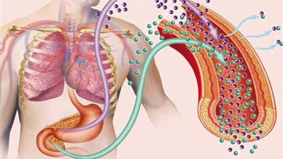 تحليل مقاومة الأنسولين، سلاحك الأول في مكافحة السكري وأمراض القلب