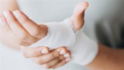 باحث بالقومي للبحوث يبتكر مرهم من منتج طبيعى لعلاج الجروح 