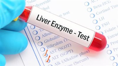 أعراض ارتفاع أنزيمات الكبد وطرق العلاج