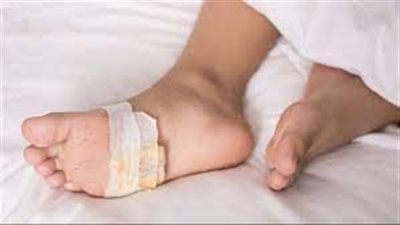  تفسير رؤية جرح القدم في المنام وعلاقته بالتخلص من المشاكل 