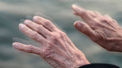 أمل جديد لإنقاذ 10 ملايين مصاب بالشلل الرعاش، اكتشاف بكتيريا مسئولة عن المرض 