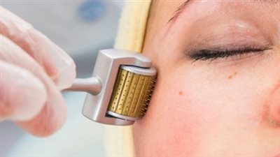 هانى الناظر: جلسات الديرما رول ليس لها فاعلية (فيديو)