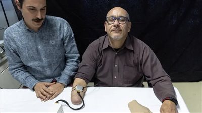 الهندسة الحيوية تمنح الأطراف الصناعية القدرة على 