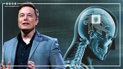بعد موافقة هيئة الغذاء والدواء عليها.. أهم قدرات شريحة إيلون ماسك للدماغ (فيديوجراف) 
