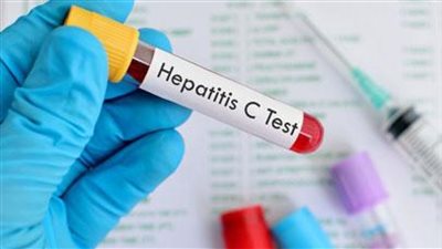 مصر تنجح في القضاء على فيروس سي بشهادة المؤسسات الدولية.. «100 مليون صحة» تفحص 63 مليون مواطن وتعالج 4.6 مليونًا.. وتقدم العلاج بالمجان لأكثر من 105 آلاف وافد 
