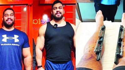 ينفق 107 آلاف دولار ليصبح أطول من زوجته