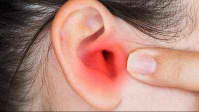 أعراض التهاب الأذن الوسطى، أبرزها ضعف السمع وصديد الأذن واضطرابات النوم 