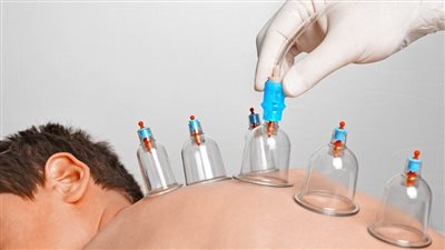 طبيب سعودي يشكك في فائدة الحجامة ويثير الجدل برفض نسبها للنبي (فيديو) 