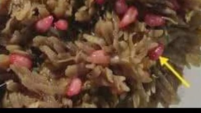 تتطلب الإعدام فورا، طبيبة بيطرية تحذر من ديدان الكرشة 