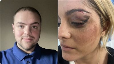 القبض على معجب ألقى هاتفه على بيبي ريكسا