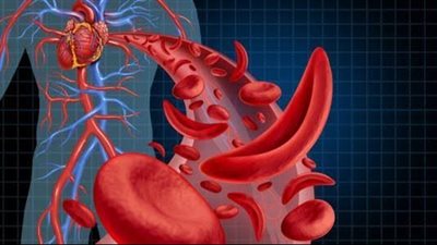  الأظافر الهشة، مؤشر للإصابة بالأنيميا ونصائح مهمة للعلاج 