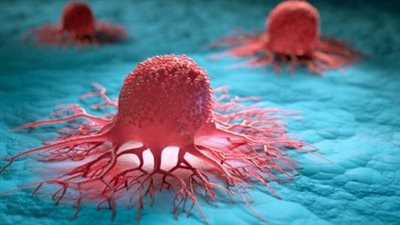 استخدام جزيئات النانو في العلاج الضوئي الديناميكي Photodynamic therapy لتدمير الخلايا السرطانية