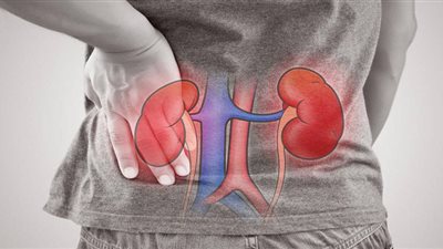 لماذا يصاب مرضى الفشل الكلوي بارتفاع ضغط الدم باستمرار؟ (فيديو) 