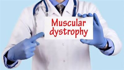 8 معلومات عن ثاني أغلى علاج في العالم لمرض ضمور العضلات دوشين