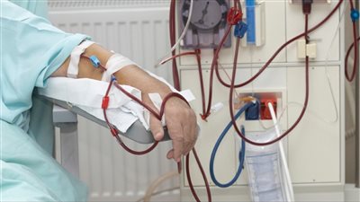 استغرقت 10 سنوات، دراسة حديثة تفتح الطريق للقضاء على الفشل الكلوي 
