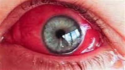 تفسير حلم خروج الدم من العين في المنام وعلاقته بالراحة وزوال الهم 