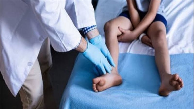مرضى ضمور العضلات
