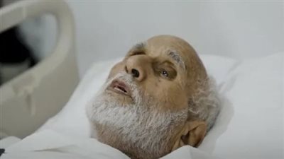 بعد أن كُسرت قدمه بالمدينة المنورة، ضم حاج مغربي إلى القافلة الطبية الخاصة