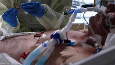 قد تستمر 6 أشهر وتصيب النساء أكثر.. 