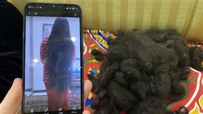 كوارث كوافير التجميل.. صلع روان وتشويه ولاء وإصابة سعودية بالعمى